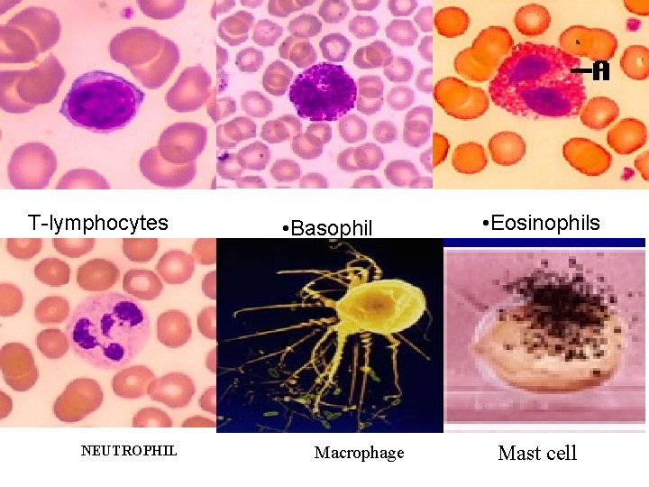 T-lymphocytes NEUTROPHIL • Basophil s Macrophage • Eosinophils Mast cell 