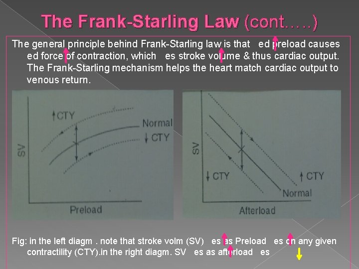 The Frank-Starling Law (cont…. . ) The general principle behind Frank-Starling law is that