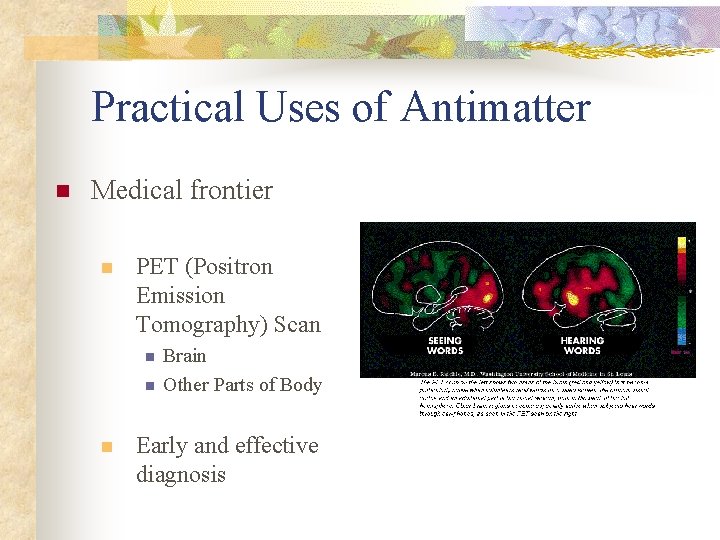 Practical Uses of Antimatter n Medical frontier n PET (Positron Emission Tomography) Scan n