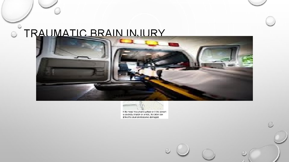 TRAUMATIC BRAIN INJURY 