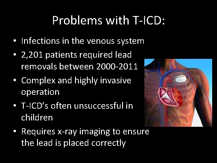 Problems with T-ICD: • Infections in the venous system • 2, 201 patients required