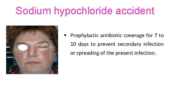 Sodium hypochloride accident § Prophylactic antibiotic coverage for 7 to 10 days to prevent