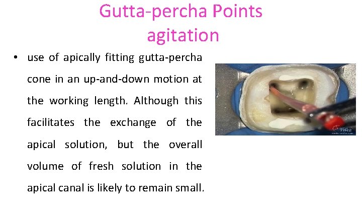 Gutta-percha Points agitation • use of apically fitting gutta-percha cone in an up-and-down motion