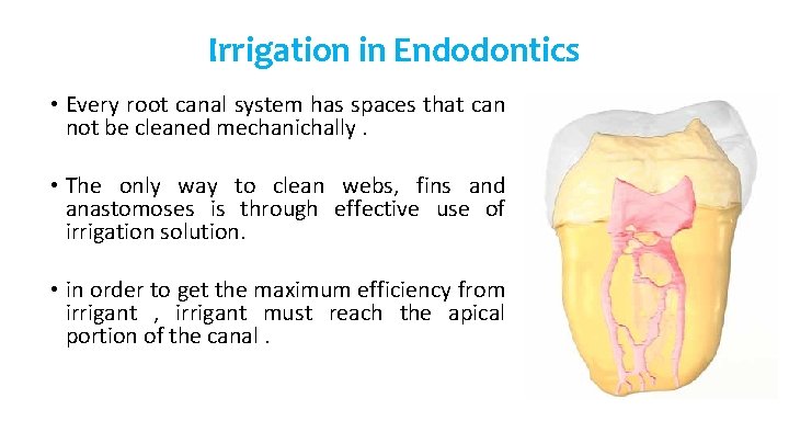 Irrigation in Endodontics • Every root canal system has spaces that can not be