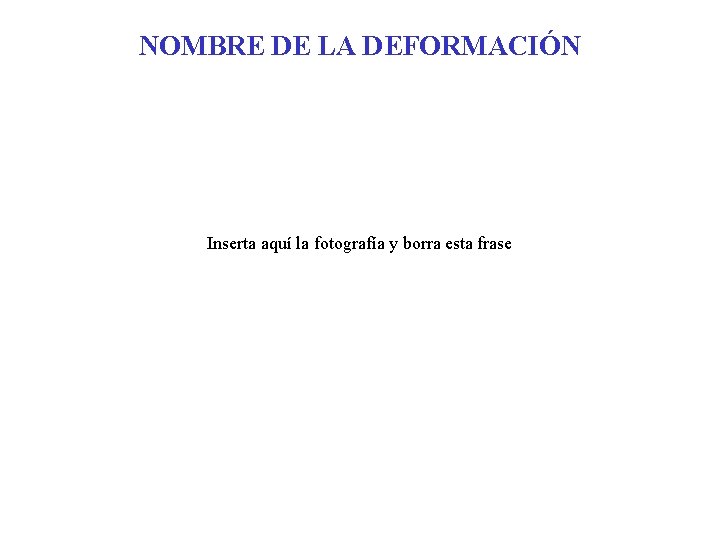 NOMBRE DE LA DEFORMACIÓN Inserta aquí la fotografía y borra esta frase 