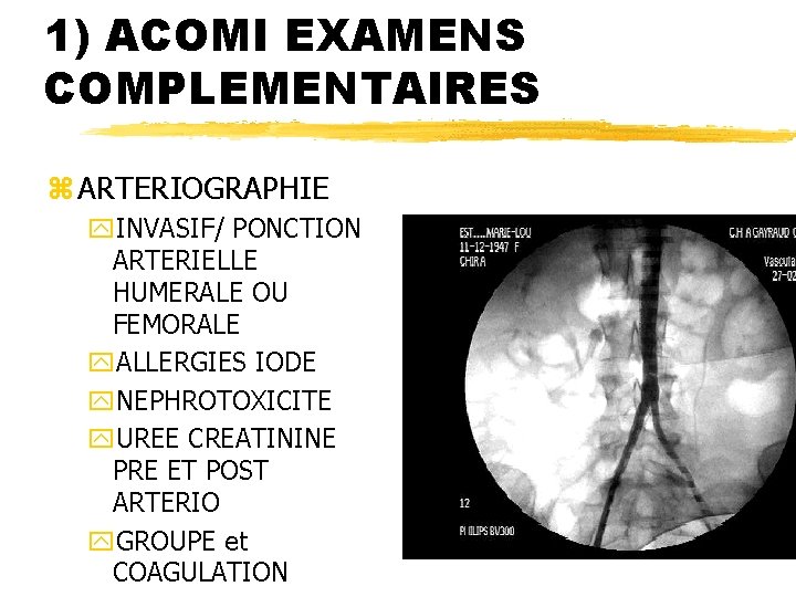 1) ACOMI EXAMENS COMPLEMENTAIRES z ARTERIOGRAPHIE y. INVASIF/ PONCTION ARTERIELLE HUMERALE OU FEMORALE y.