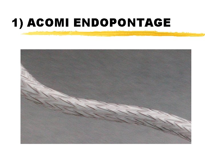 1) ACOMI ENDOPONTAGE 