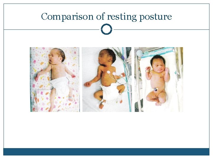 Comparison of resting posture 