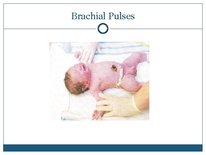 Brachial Pulses 