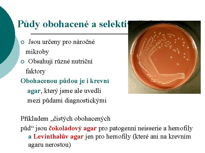 Půdy obohacené a selektivně obohacené Jsou určeny pro náročné mikroby ¡ Obsahují různé nutriční