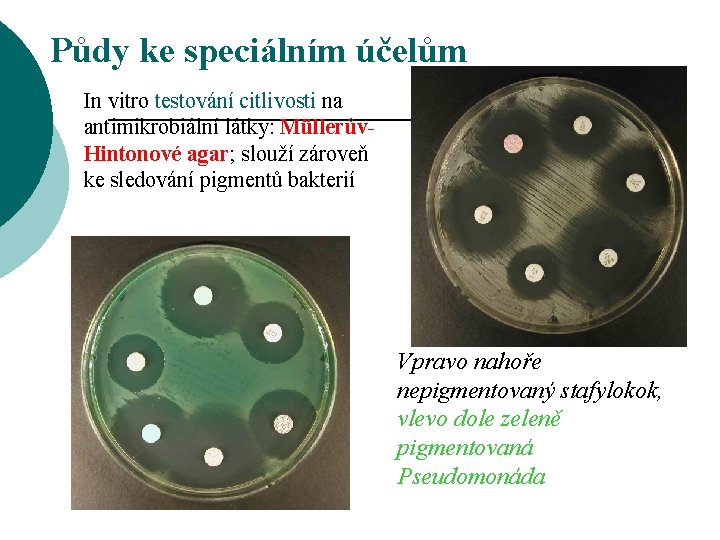 Půdy ke speciálním účelům In vitro testování citlivosti na antimikrobiální látky: Müllerův. Hintonové agar;