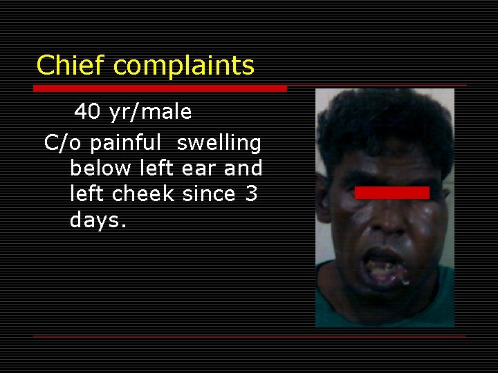 Chief complaints 40 yr/male C/o painful swelling below left ear and left cheek since