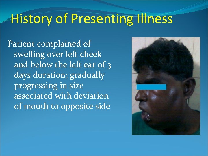 History of Presenting Illness Patient complained of swelling over left cheek and below the