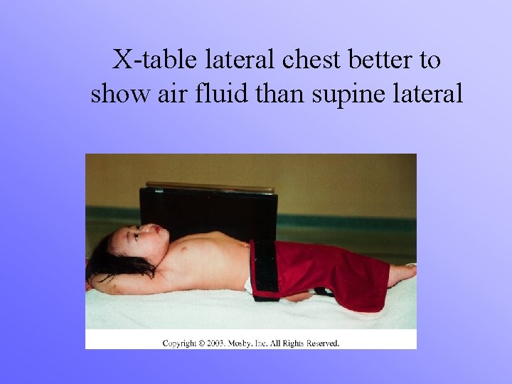 X-table lateral chest better to show air fluid than supine lateral 
