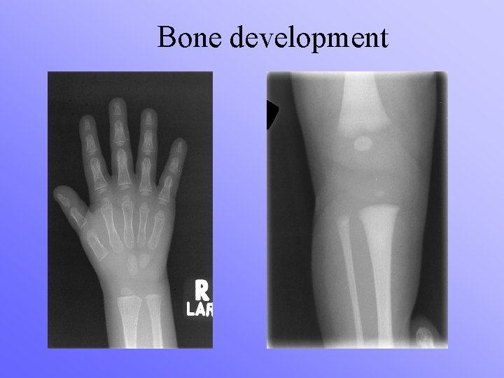 Bone development 