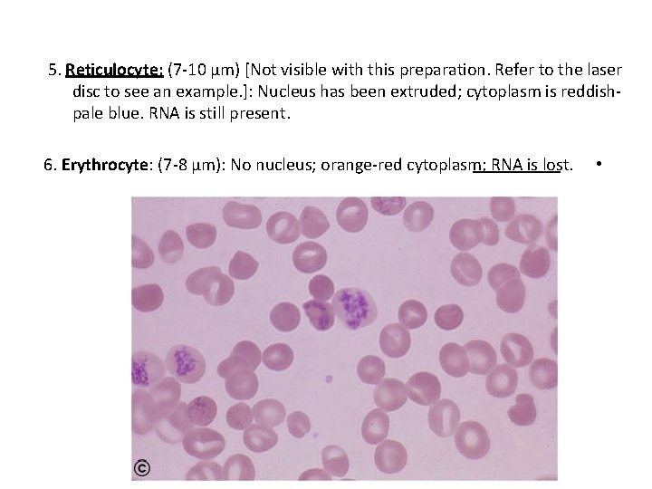 5. Reticulocyte: (7 -10 µm) [Not visible with this preparation. Refer to the laser