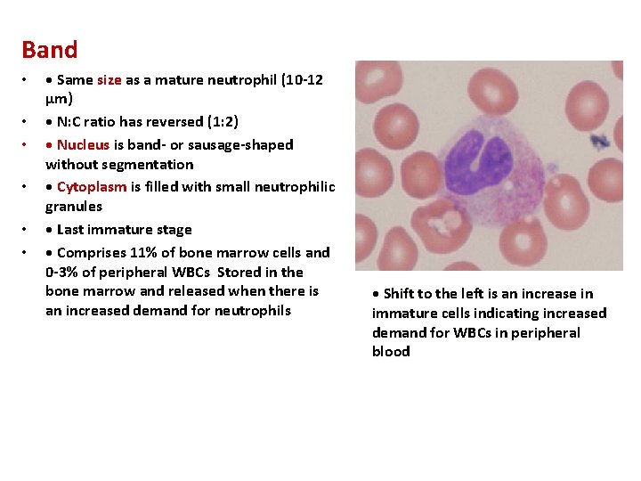 Band • • Same size as a mature neutrophil (10 -12 μm) • N: