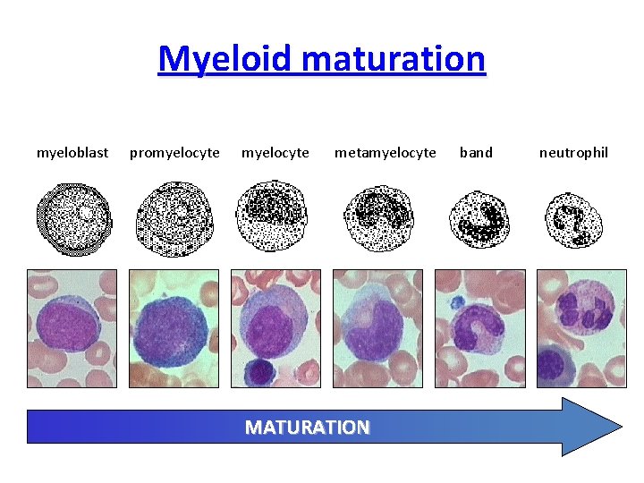 Myeloid maturation myeloblast promyelocyte metamyelocyte MATURATION band neutrophil 