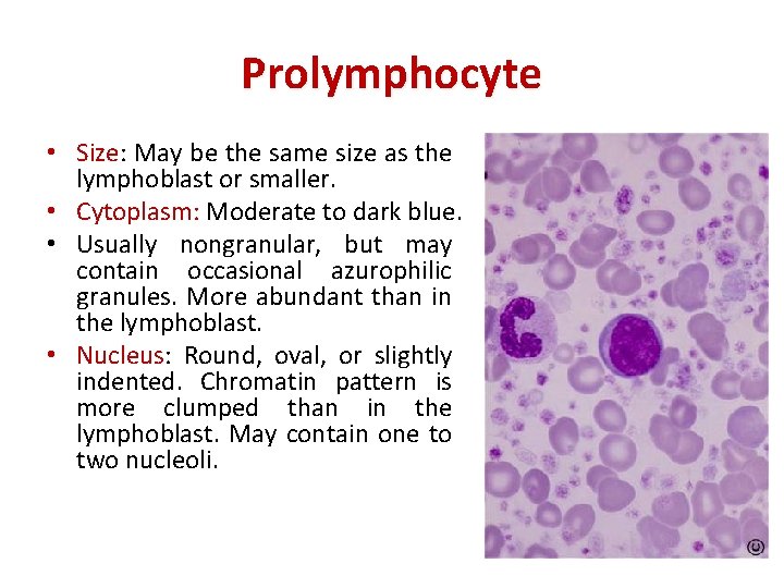 Prolymphocyte • Size: May be the same size as the lymphoblast or smaller. •