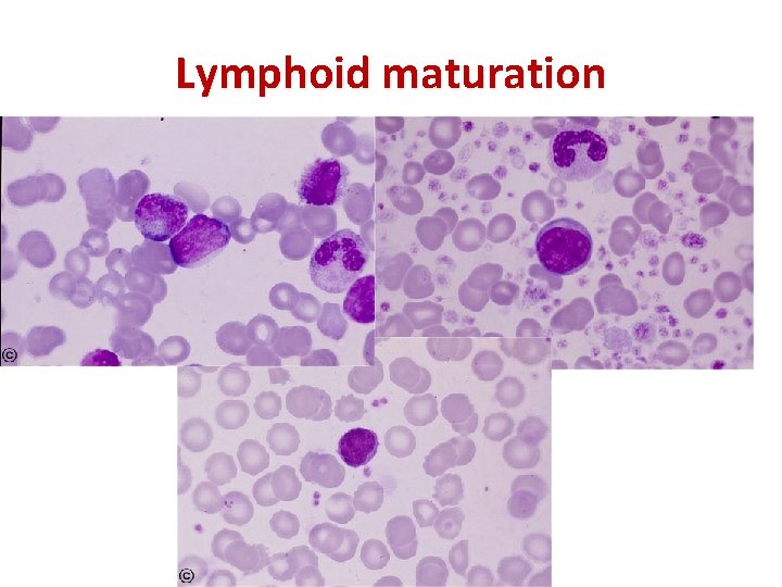 Lymphoid maturation 