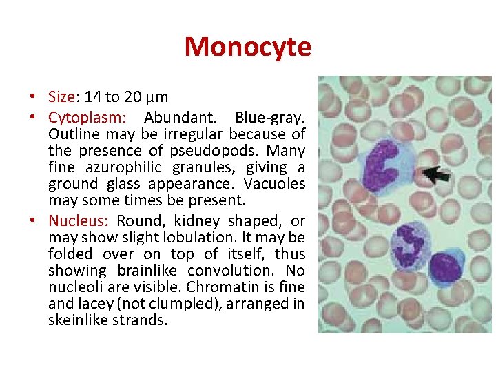 Monocyte • Size: 14 to 20 µm • Cytoplasm: Abundant. Blue-gray. Outline may be