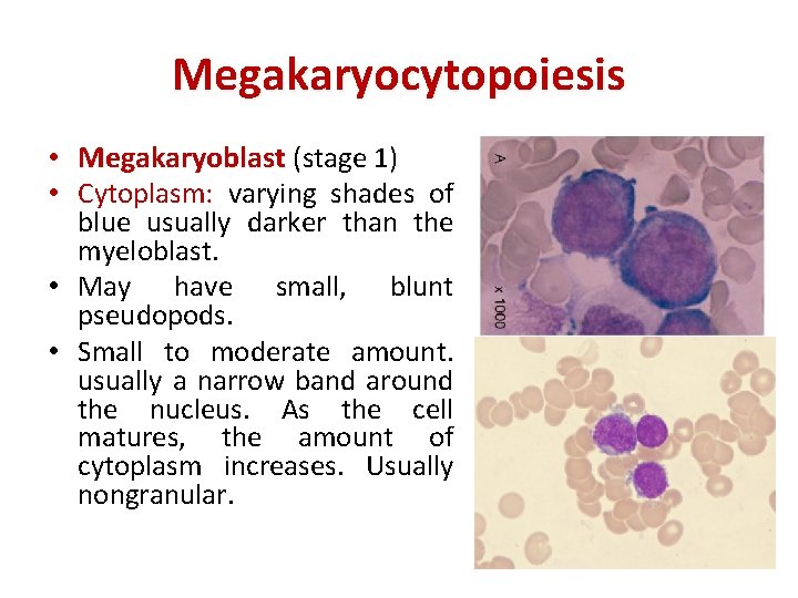Megakaryocytopoiesis • Megakaryoblast (stage 1) • Cytoplasm: varying shades of blue usually darker than