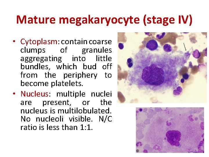 Mature megakaryocyte (stage IV) • Cytoplasm: contain coarse clumps of granules aggregating into little
