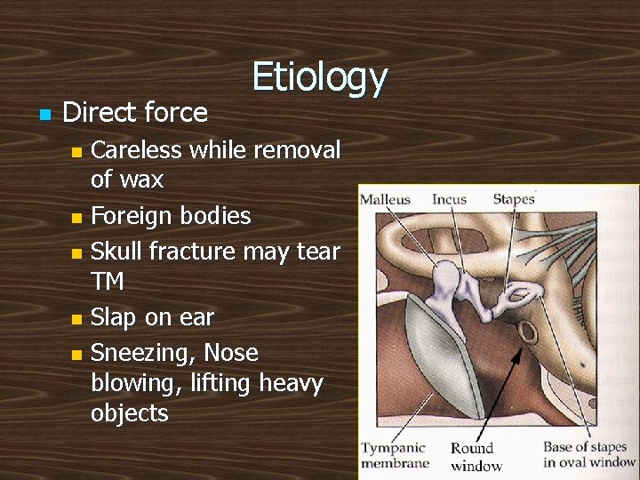 n Direct force Etiology Careless while removal of wax n Foreign bodies n Skull