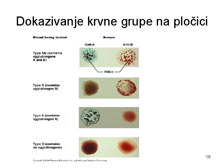 Dokazivanje krvne grupe na pločici 18 