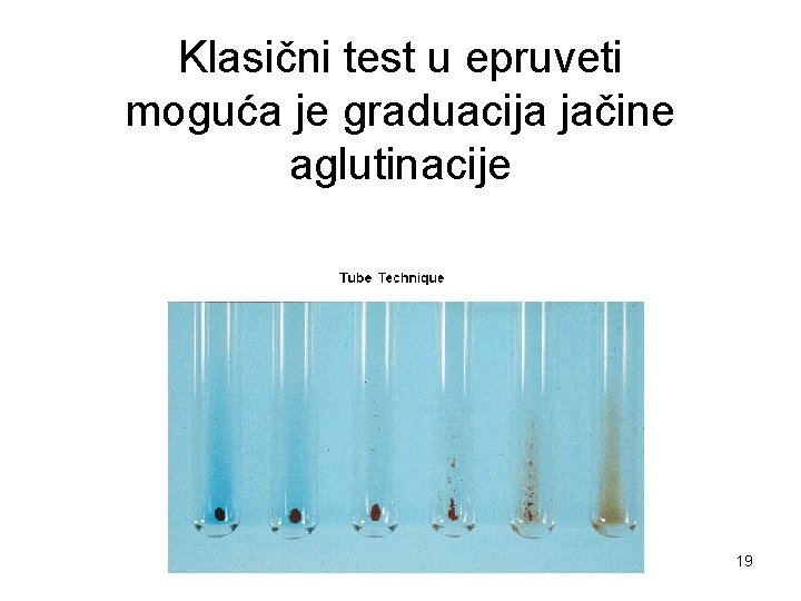 Klasični test u epruveti moguća je graduacija jačine aglutinacije 19 