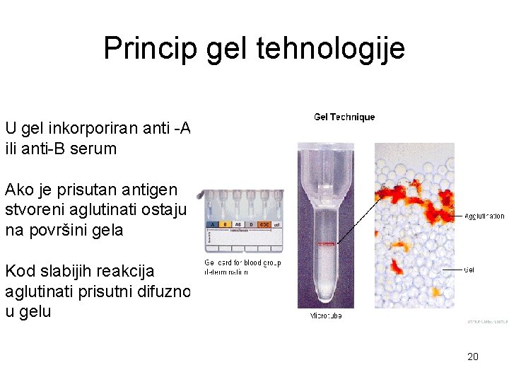 Princip gel tehnologije U gel inkorporiran anti -A ili anti-B serum Ako je prisutan