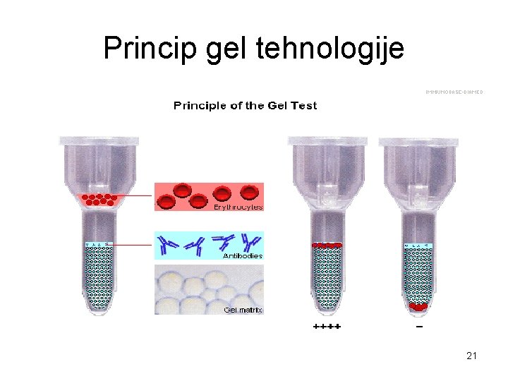 Princip gel tehnologije 21 