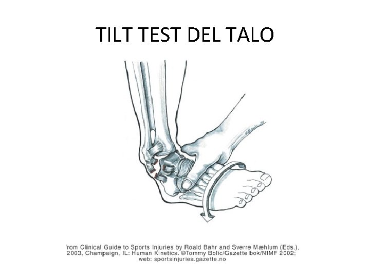 TILT TEST DEL TALO 