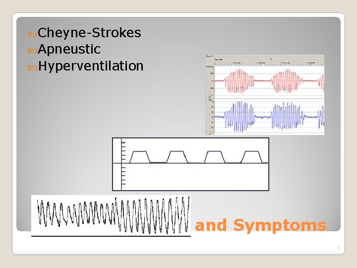  Cheyne-Strokes Apneustic Hyperventilation Respiratory Signs and Symptoms 6 