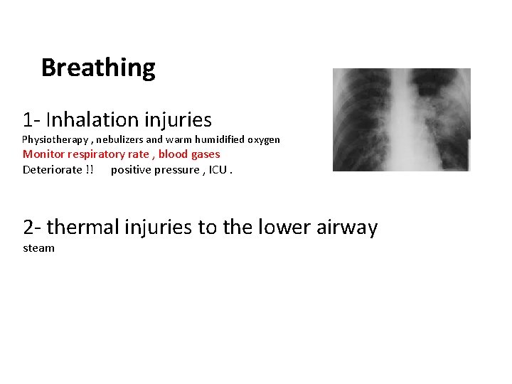 Breathing 1 - Inhalation injuries Physiotherapy , nebulizers and warm humidified oxygen Monitor respiratory