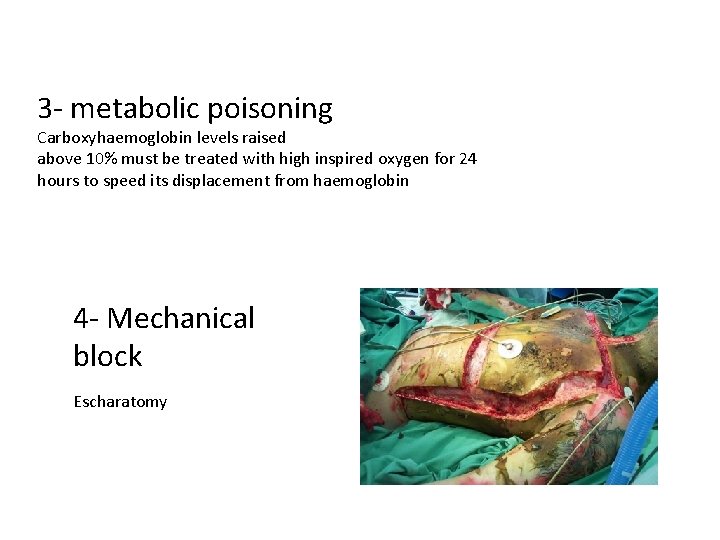 3 - metabolic poisoning Carboxyhaemoglobin levels raised above 10% must be treated with high