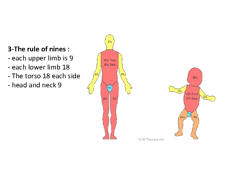 3 -The rule of nines : - each upper limb is 9 - each