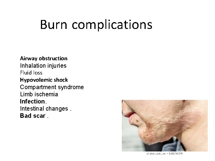 Burn complications Airway obstruction Inhalation injuries Fluid loss Hypovolemic shock Compartment syndrome Limb ischemia
