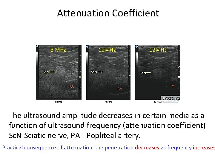 Attenuation Coefficient 8 MHz 10 MHz 12 MHz The ultrasound amplitude decreases in certain