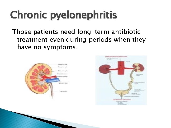 Chronic pyelonephritis Those patients need long-term antibiotic treatment even during periods when they have