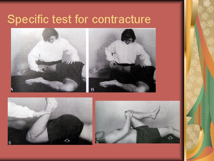 Specific test for contracture 