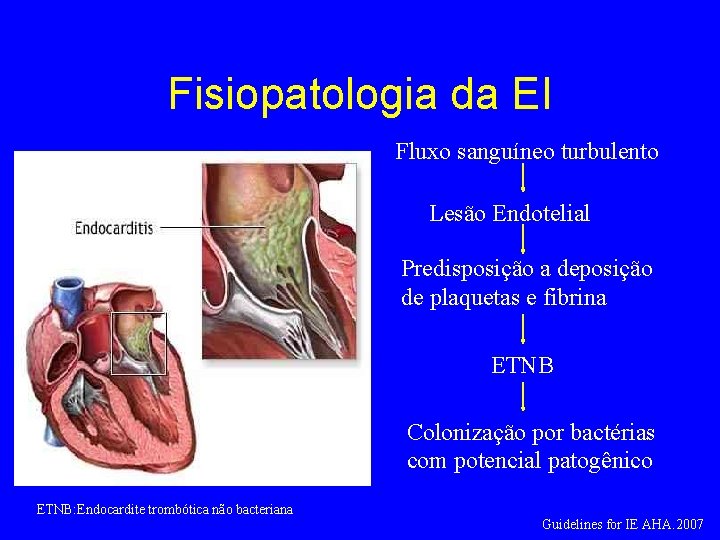 Fisiopatologia da EI Fluxo sanguíneo turbulento Lesão Endotelial Predisposição a deposição de plaquetas e