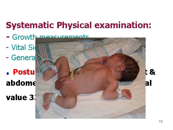 Systematic Physical examination: - Growth measurements - Vital Signs - General appearance: . Posture: