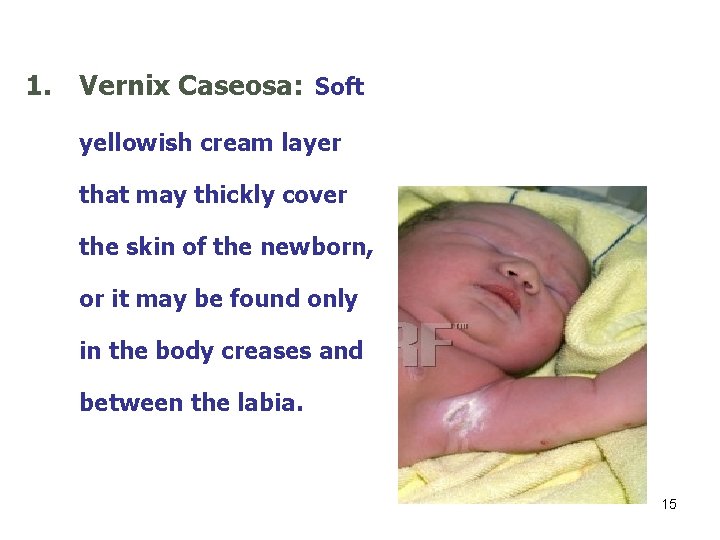 1. Vernix Caseosa: Soft yellowish cream layer that may thickly cover the skin of