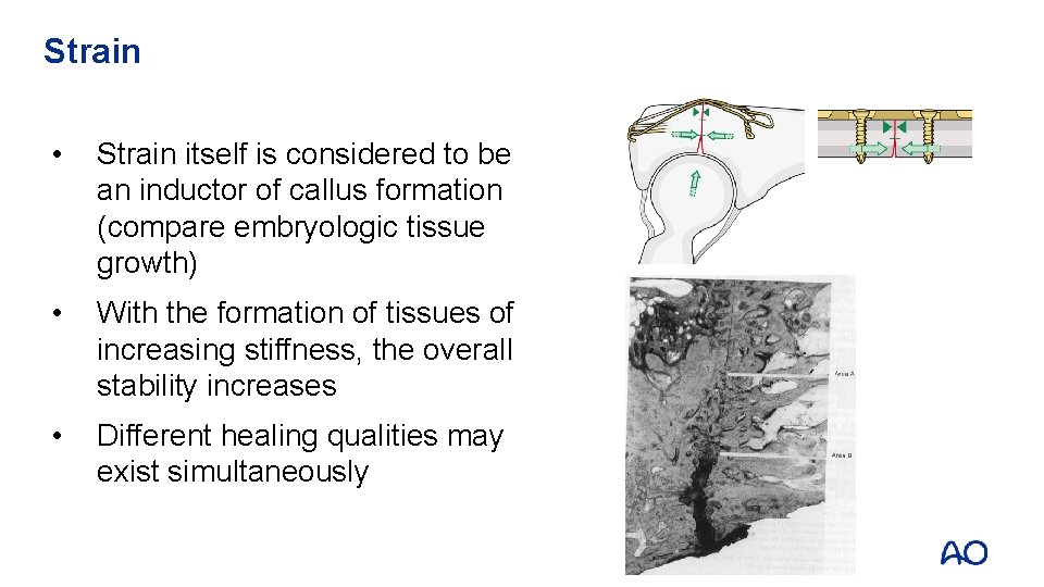 Strain • Strain itself is considered to be an inductor of callus formation (compare