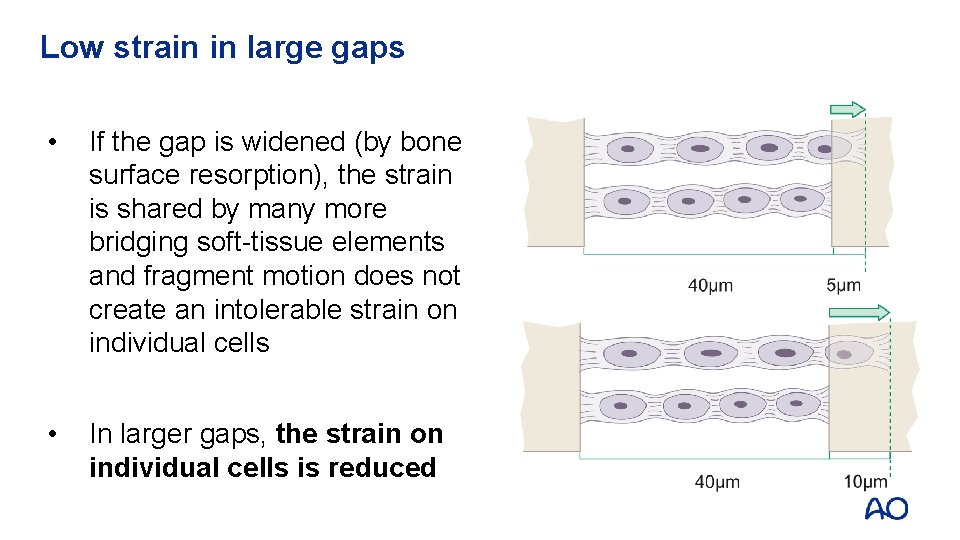 Low strain in large gaps • If the gap is widened (by bone surface