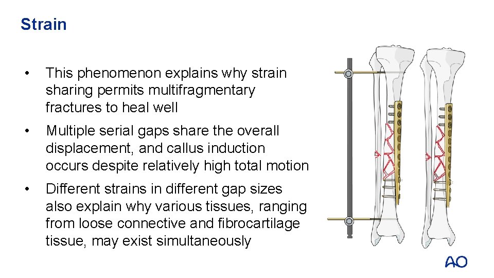 Strain • This phenomenon explains why strain sharing permits multifragmentary fractures to heal well