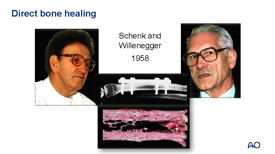 Direct bone healing Schenk and Willenegger 1958 
