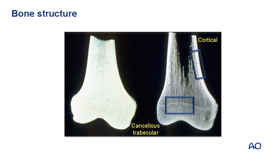 Bone structure Cortical Cancellous trabecular 