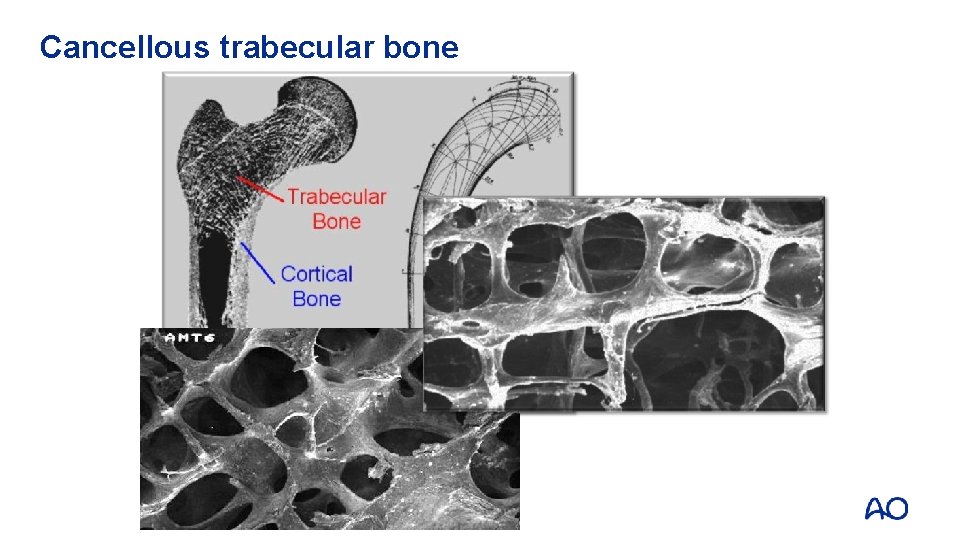 Cancellous trabecular bone 